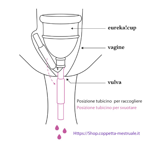come funziona coppetta eureka