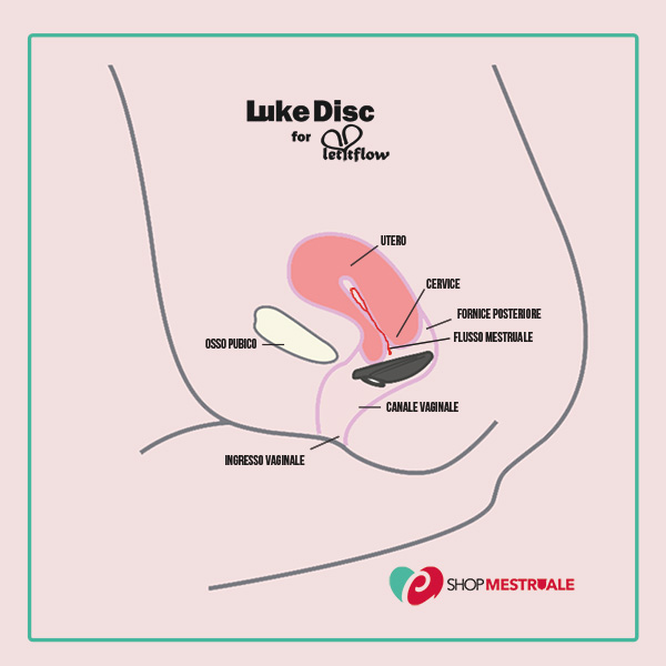 disegno grafico dell'apparato riproduttivo femminile e su come va posizionato il disco mestruale brand Lukedisc dentro la vagina